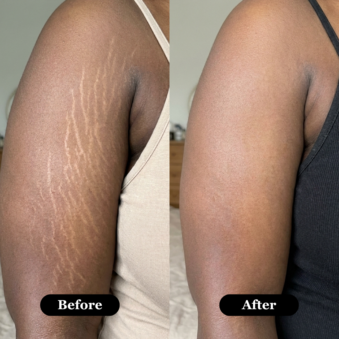 Perkie Retinal Body Serum